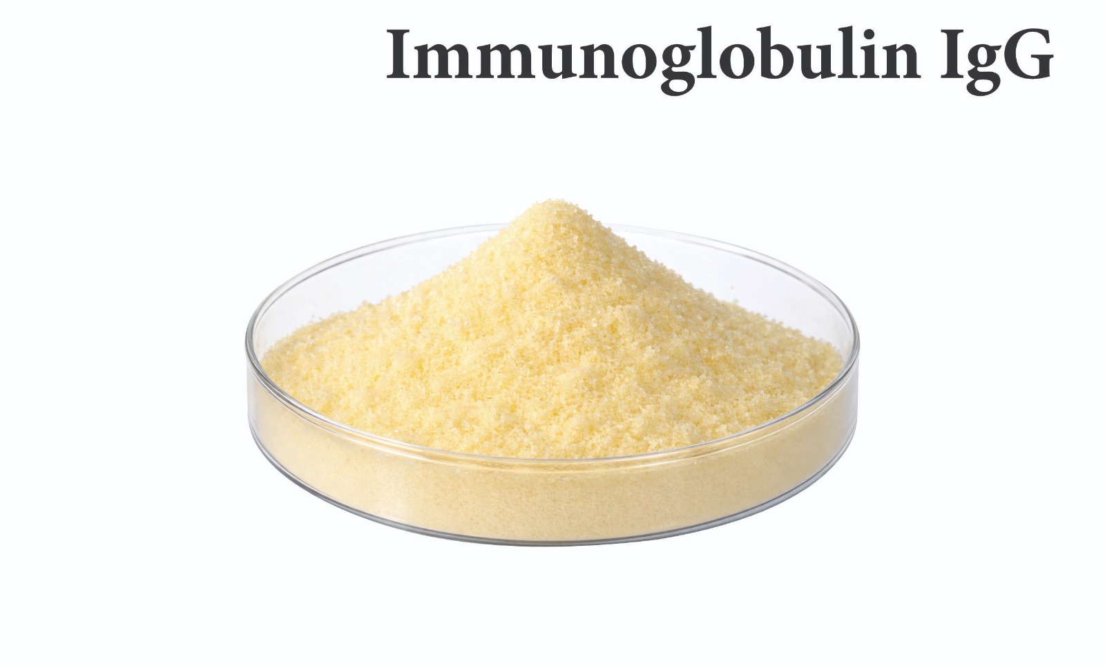 Immunoglobulin-G-IgG